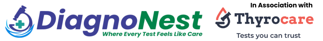 DiagnoNest logo – Where Every Test Feels Like Care – in association with Thyrocare, Tests you can trust.